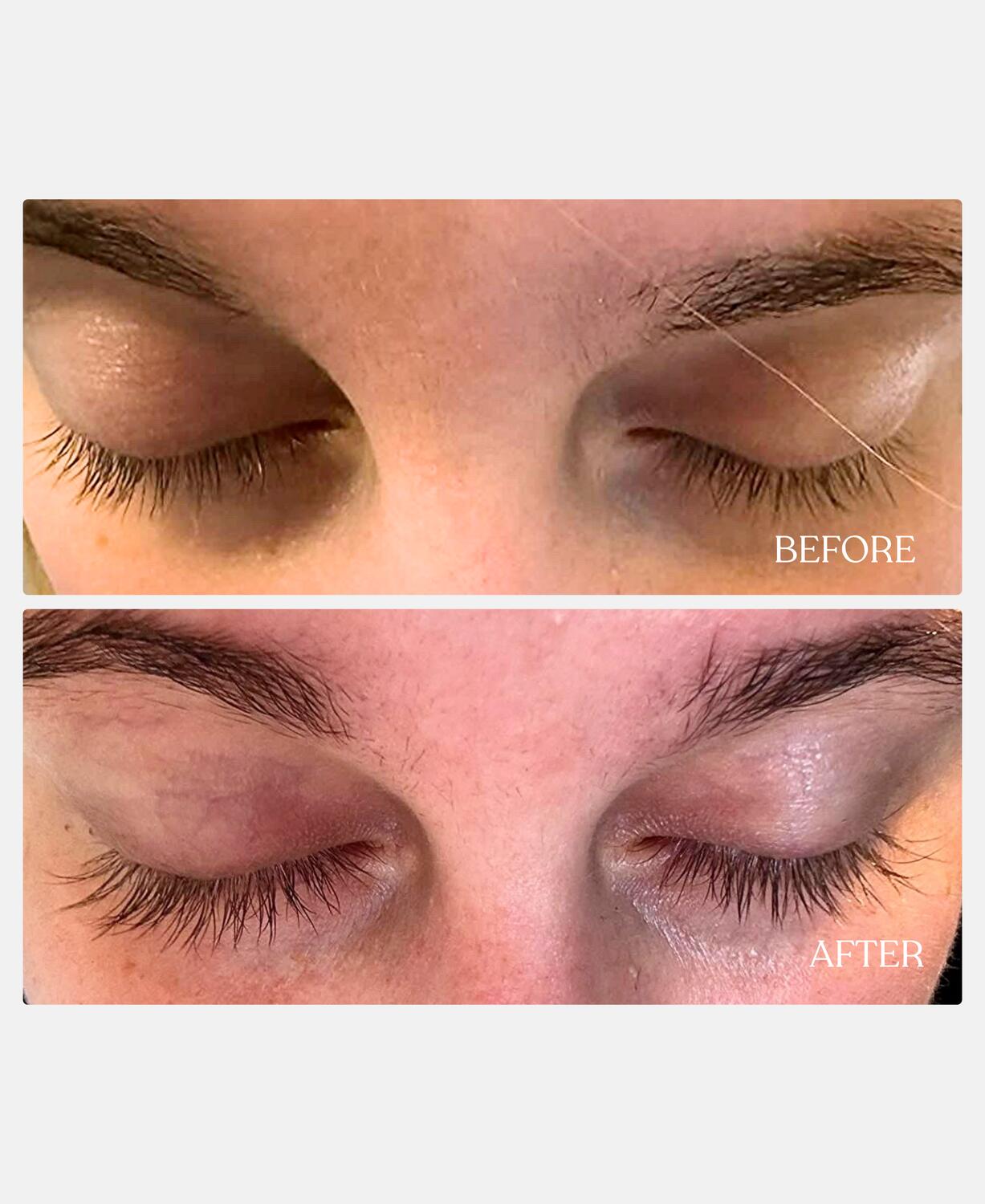 Øjenvippe serum - 3 ml